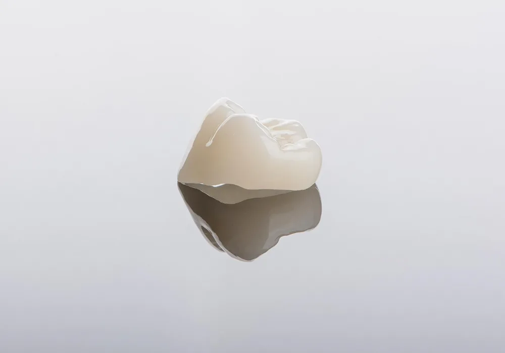 Lucrare protetica coroana dentara
