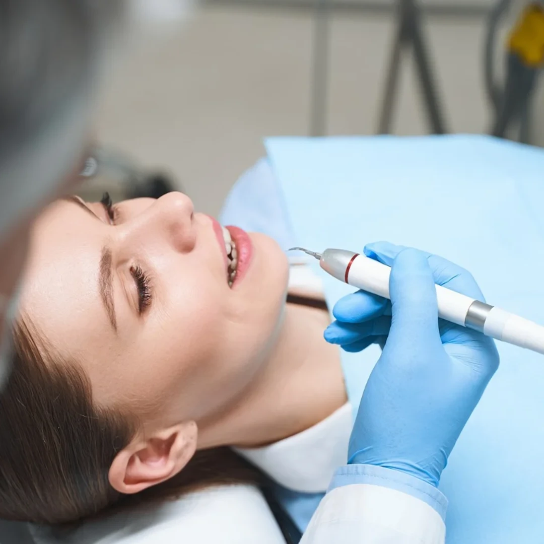 Profilaxie dentara indepartare placa bacteriana detartraj cu ultrasunete