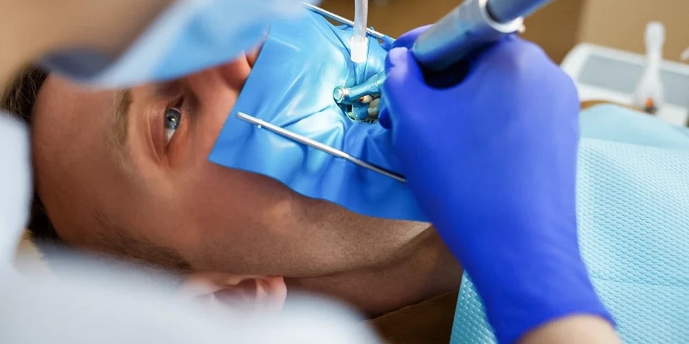 Sistem de izolare dinti cu Diga pentru restaurarea dintilor la Clinica JoliDent