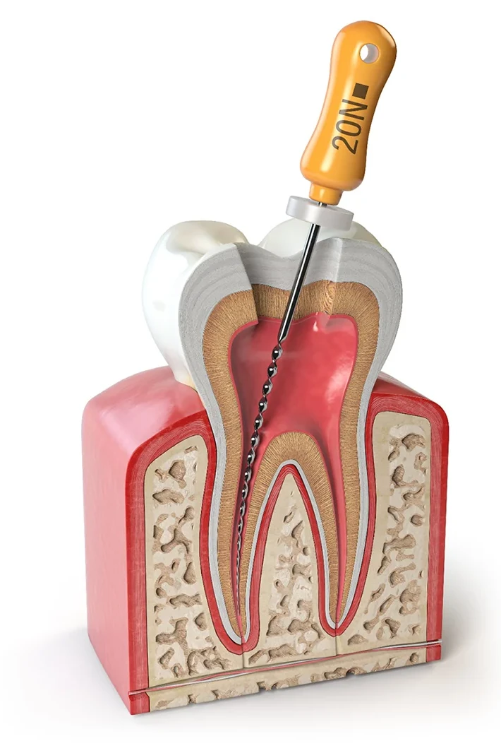 Tratamentul ortodontic in Buzau, clinica Jolident