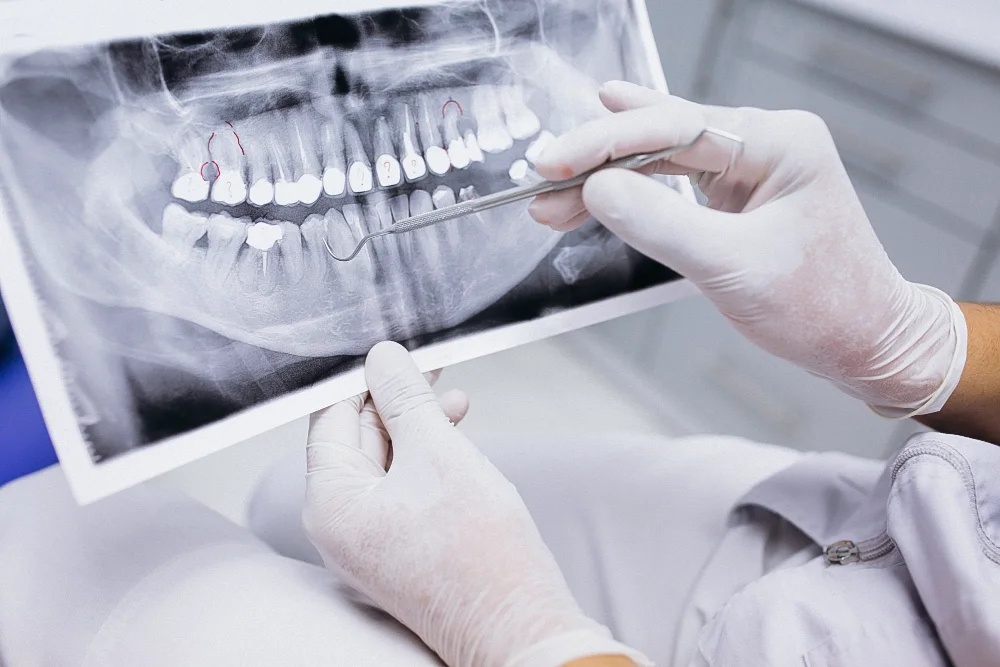 Radiografie dentara ponoramica